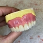 سازنده انواع دندان مصنوعی